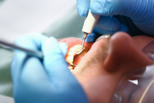 Reliable WI Emergency Dental Service Solutions